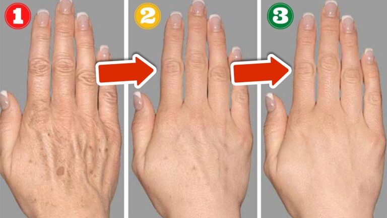7 Natural Remedies to Erase Age Spots for Good – Discover Now!