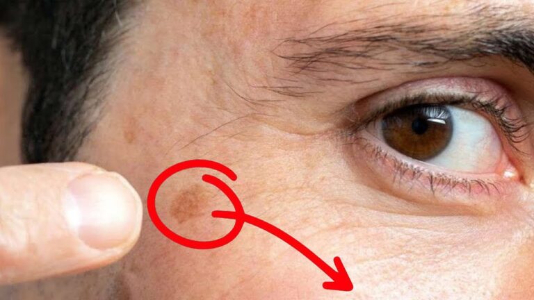 Remove Age Spots Overnight with This 1 Secret Oil! Discover How Today!