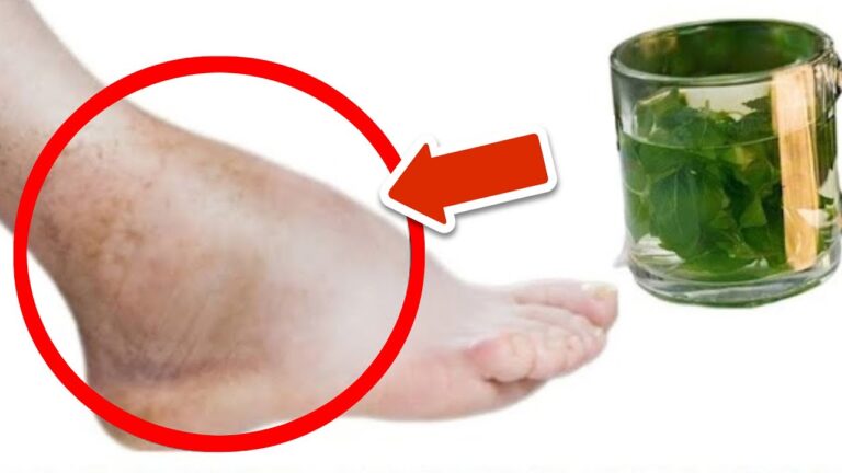 Say Goodbye to Swollen Feet: 5 Teas That Work Wonders for Lasting Relief!
