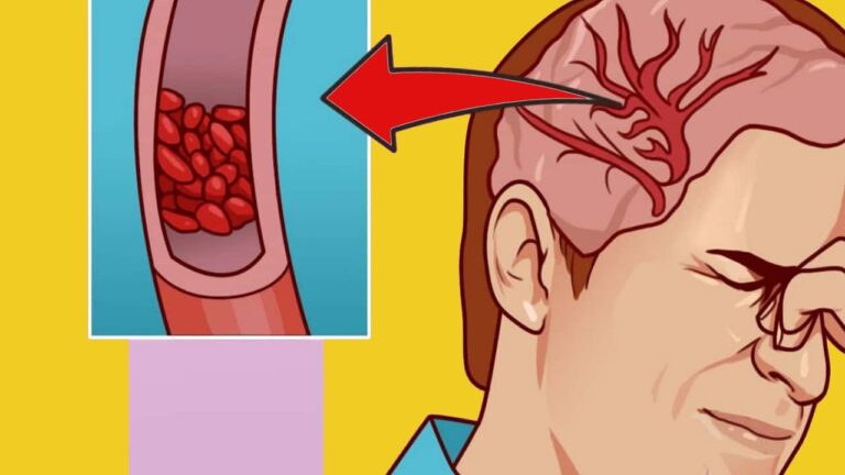 10 Signs Your Body Needs Magnesium Now for Better Health!💥