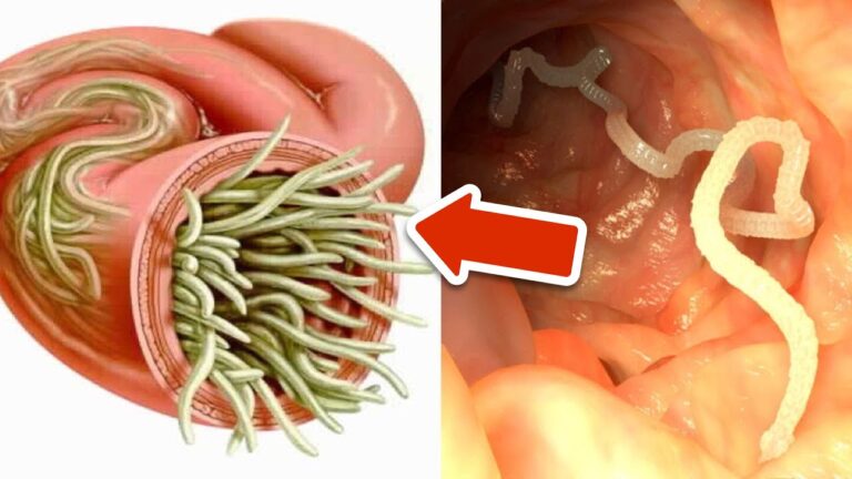 7 Powerful Herbs to Naturally Eliminate Internal Parasites You Need to Know!