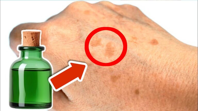 5 Essential Oils to Banish Age Spots Fast and Easy!