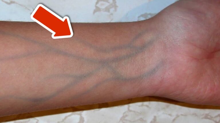 5 Signs of Poor Circulation You Must Never Ignore for Better Health!