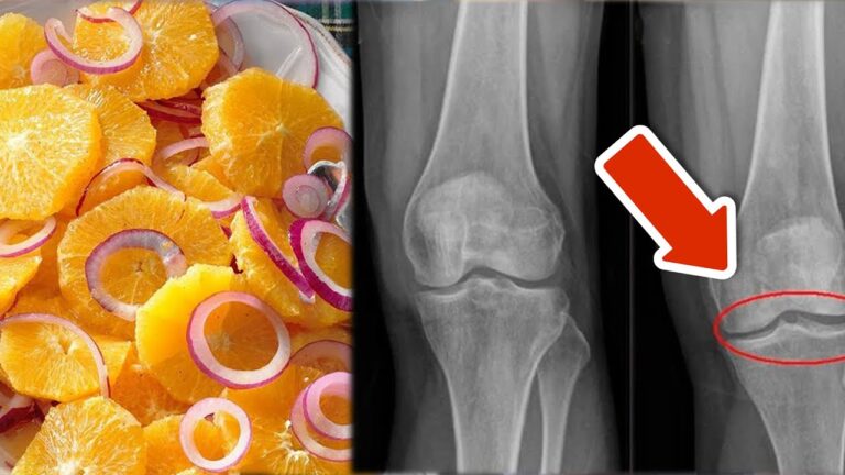 8 Simple Ways to Strengthen Your Knees and Joints Today!💪✨
