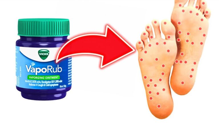 Discover 5 Surprising Benefits of Vicks VapoRub on Your Feet!