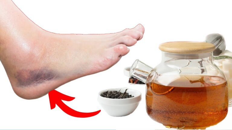 6 Teas to Reduce Swollen Legs and Joints for Good!