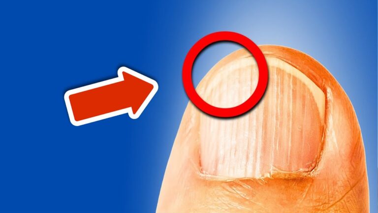 7 Signs Your Body Needs Nutrients: Discover These 7 Vital Clues Now!