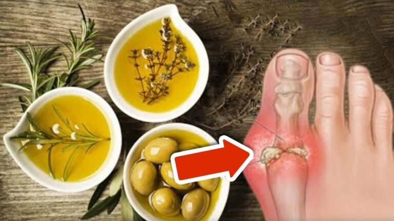 8 Simple Ways to Lower Uric Acid Levels and Feel Great Today!