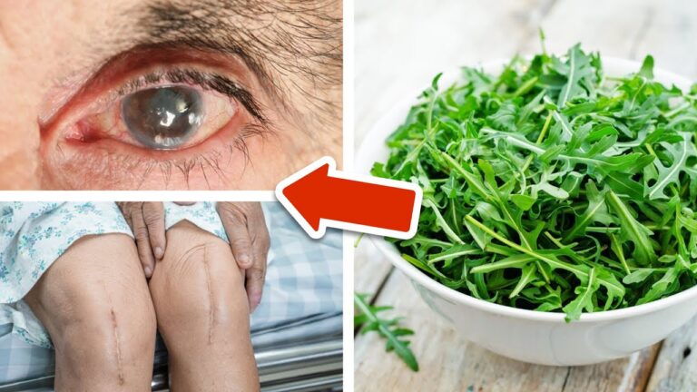 Discover 7 Shocking Benefits of Eating Arugula Daily That Will Transform Your Health!