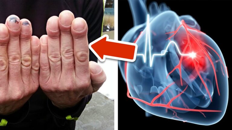 8 Health Issues You Can Spot Just by Looking at Your Hands! Discover What They Mean!