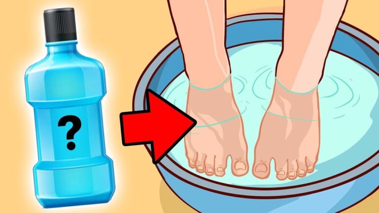 Destroy Nail Fungus in 1 Easy Step with This Revolutionary Method!