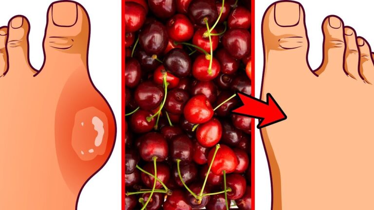 4 Benefits of Adding Cherries to Your Daily Diet Today!